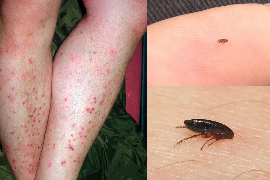 Обработка от всех видов насекомых