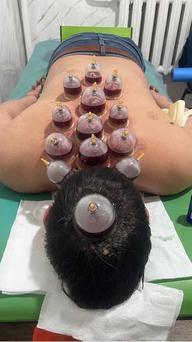 Хиджама и шертпе в городе Алматы