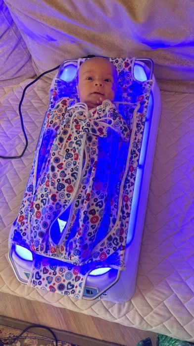 Аренда фотолампы, фотолампа, лампа от желтушки, желтуха