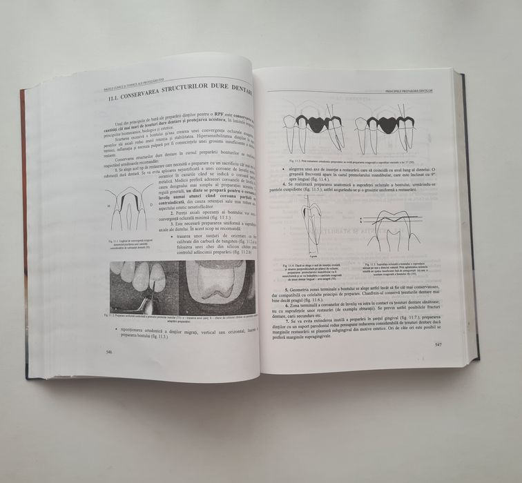 Bazele clinice si tehnice ale protezarii fixe - Bratu