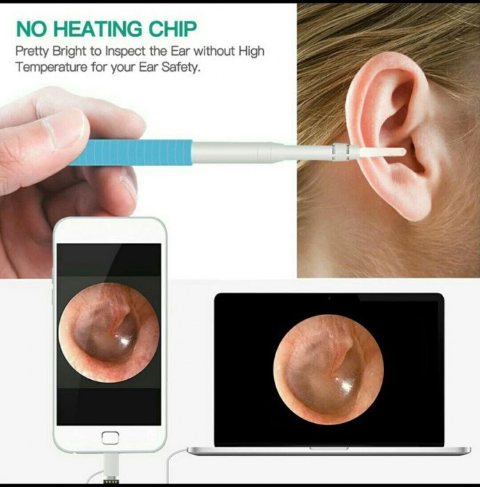 Медицинский эндоскоп мини отоскоп камера для лор хирург стоматолог