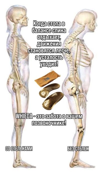Стельки коррекционные в наличии