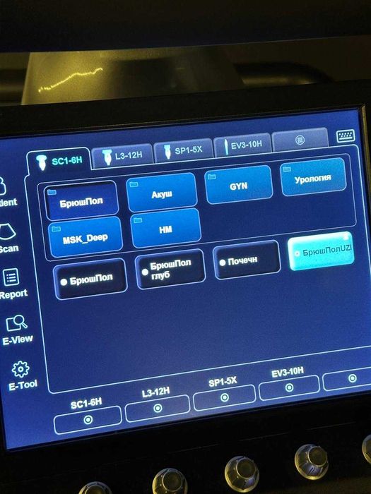 Универсальная УЗИ система Alpinion E-CUBE 15 для клиники