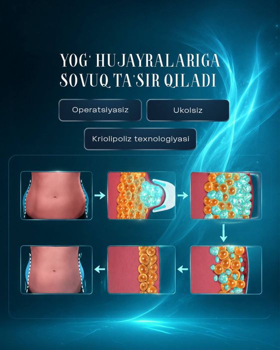 Криолиполиз аппарат