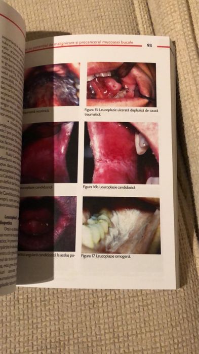 Medicina si Patologie Orala-TOVARU-VOL I / EDITIA A - II - A 2012