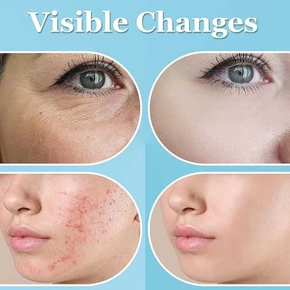 Дарсонвал UUPAS преносима високочестотна машина за лице с 6 накрайника