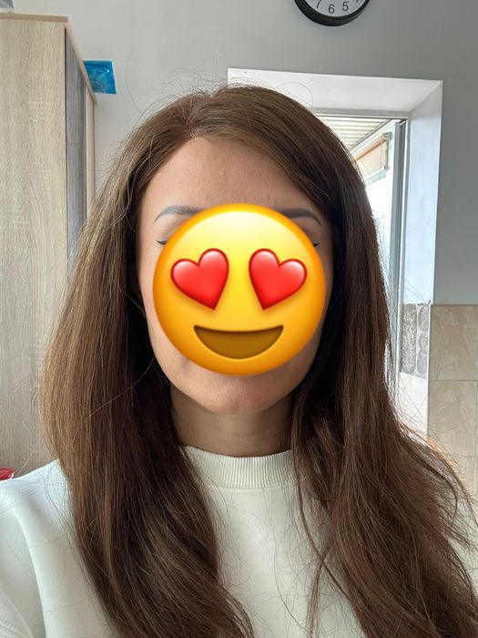 Продам систему волос