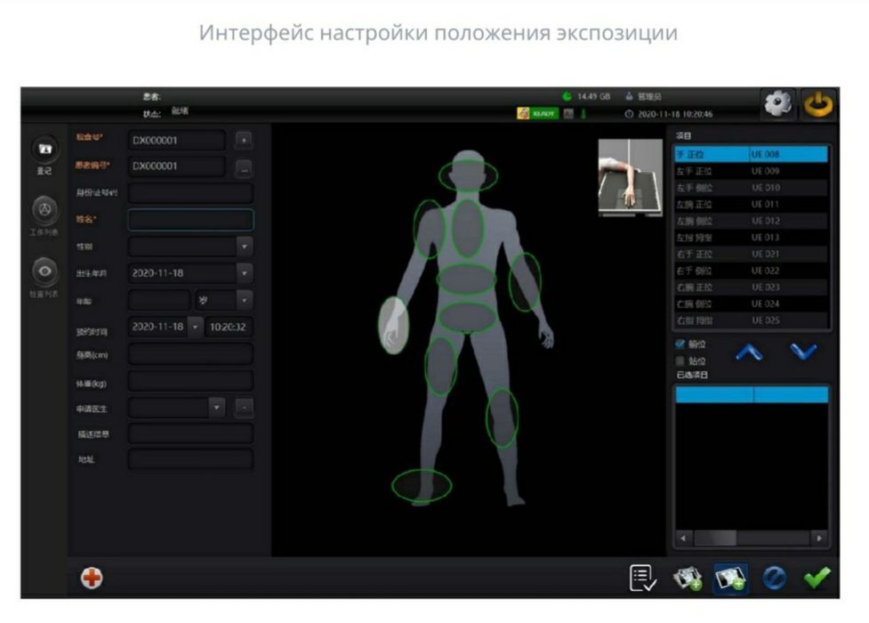 Портативный цифровой рентген аппарат. Mobile X-ray