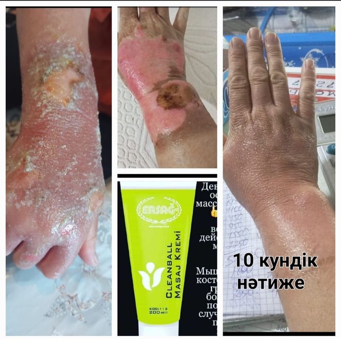 Массажный крем эрсаг