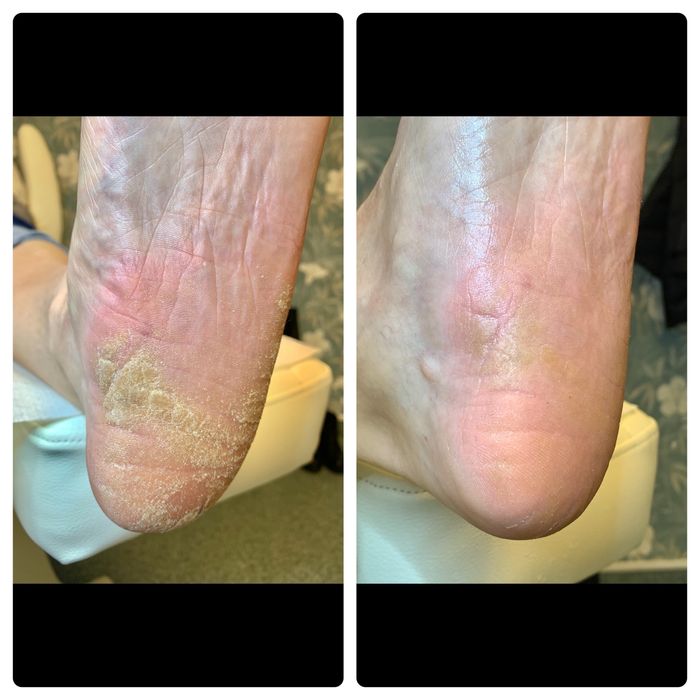 Pedichiură complexă