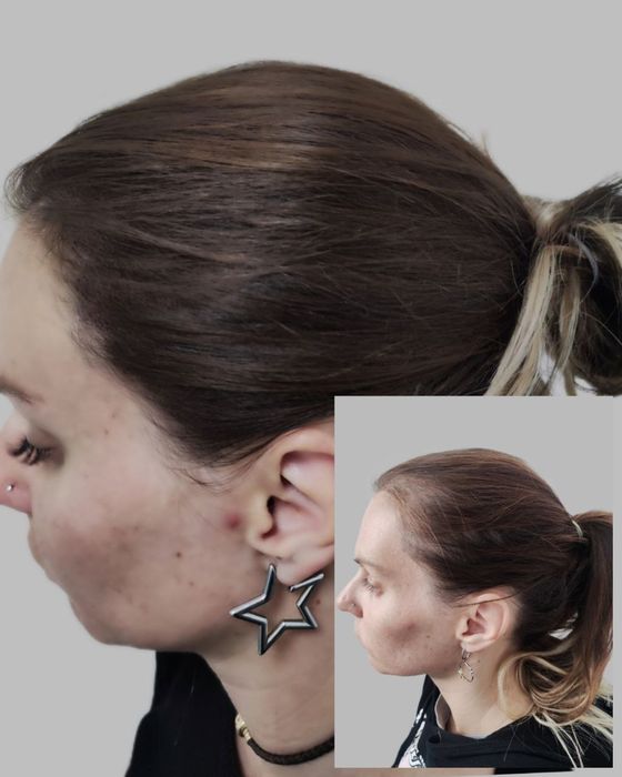 Трихопигментация волос