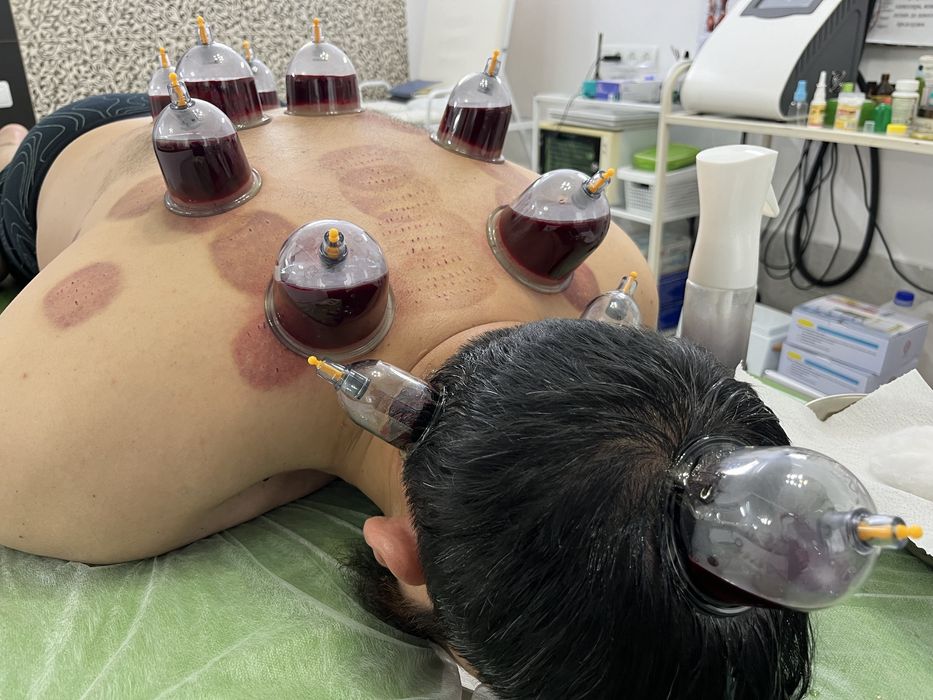 Хиджама в г.Актау