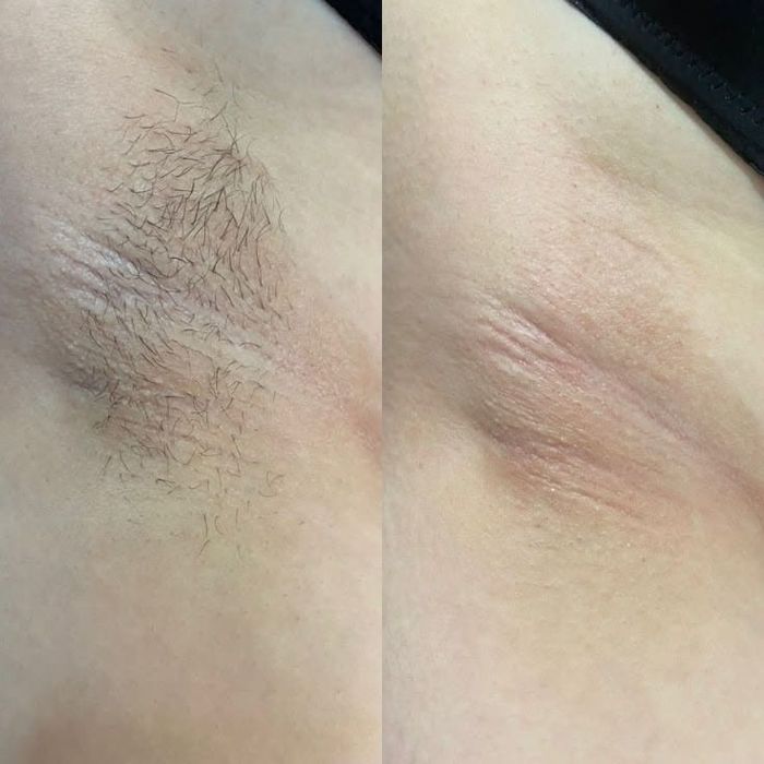 Мужской комплекс