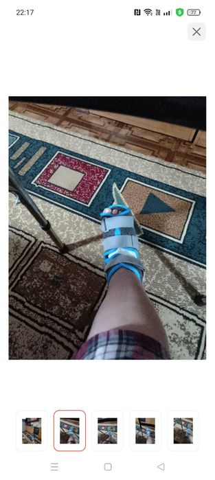 Ортез на голеностоп