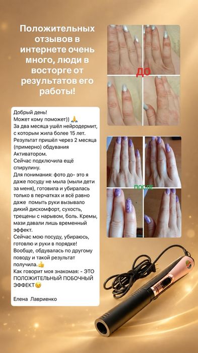 Прибор активирует клетки. Оригинал