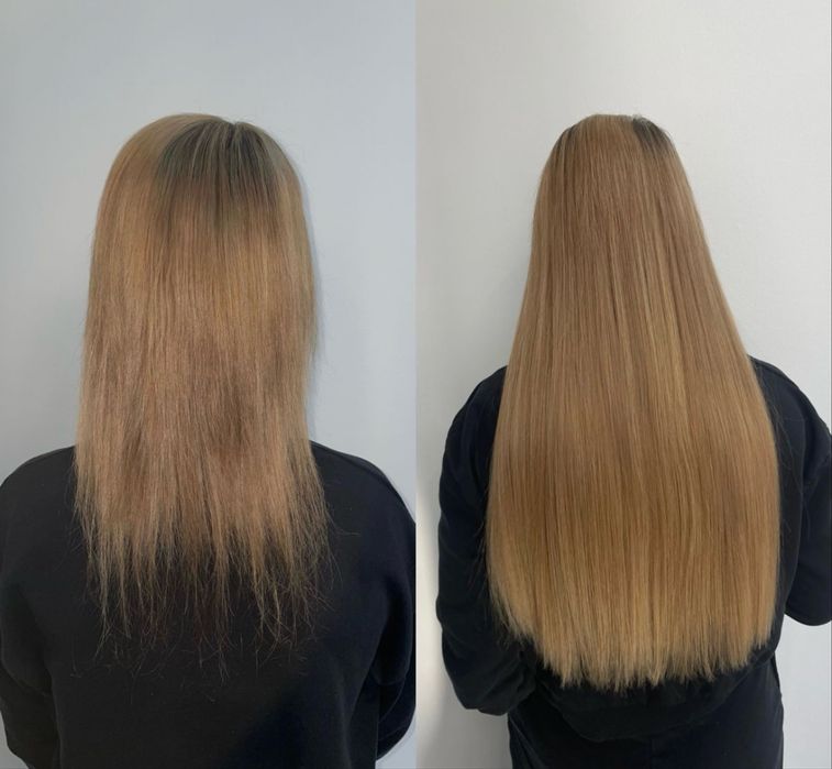 Aplic extensii Tape-On