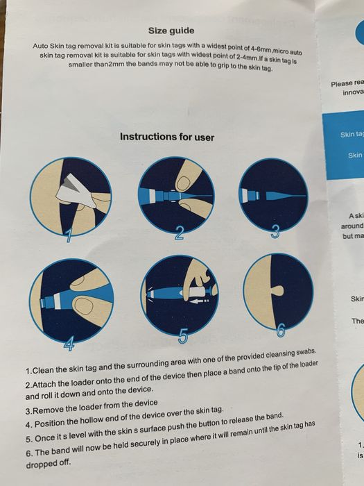 Устройство удаление папиллом