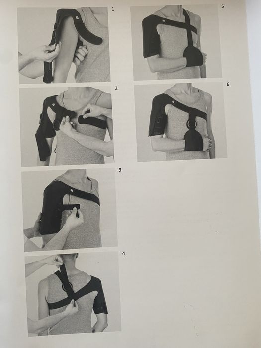 Шина MEDI за счупена раменна кост