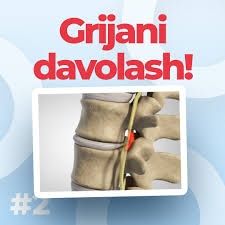 Grija (Churra) davolash