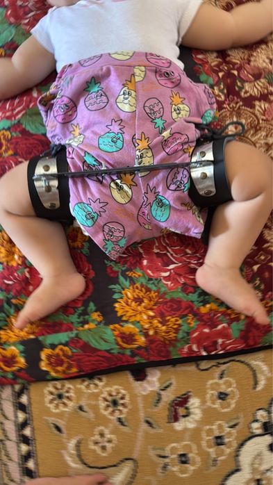 Ортопедические шины