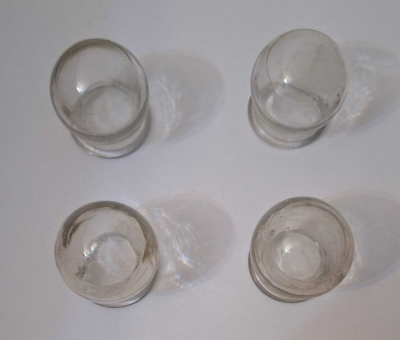 Гинекологические зеркала, новые - 2, б/у - 1