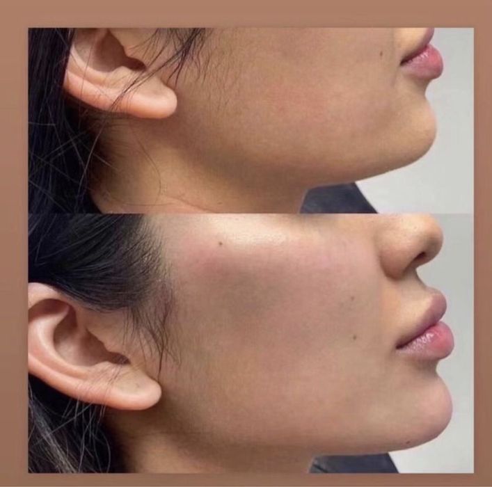 Услуги косметолога эстетиста! Все виды процедур