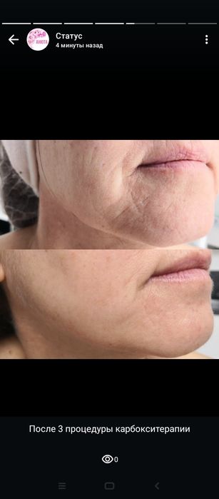 Услуги косметолога