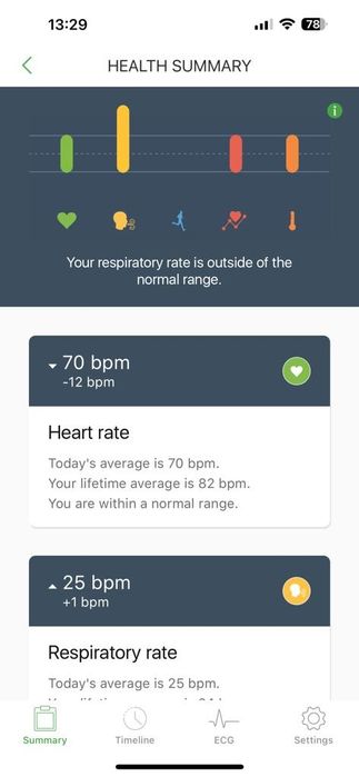 Qardio Core monitorizare cardio