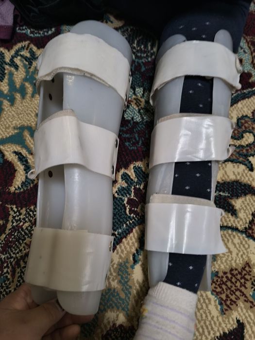 Тутор шина ало холатда