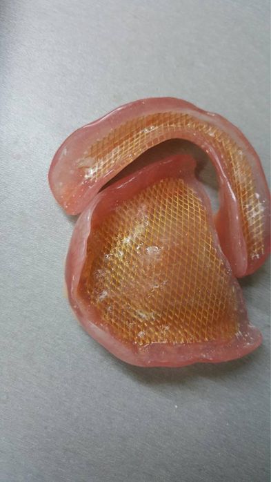 Протез зубной био