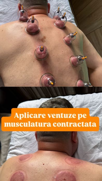 Masaj/kinetoterapie/chiropractica/recuperare la domiciliu