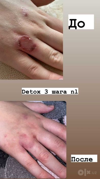 Для очищения DETOX STEP PLUS организм тозалашни безарар усули