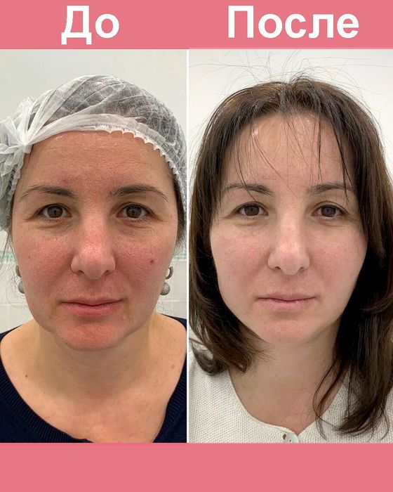 Косметолог стаж 30 лет