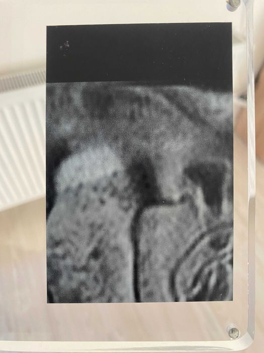 Plachetă comemorativă VIP serialul House MD (unică) cu radiografie