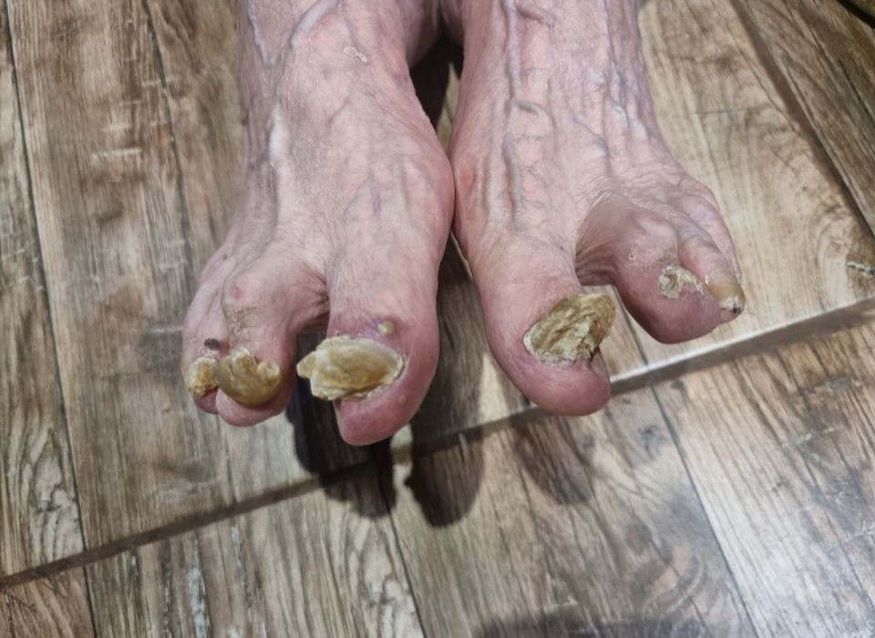 Модул " Медицински педикюр "