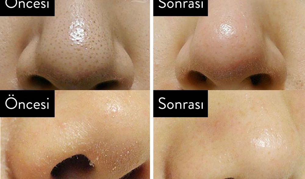 Скраб, пилинг за тяло с невероятен резултат