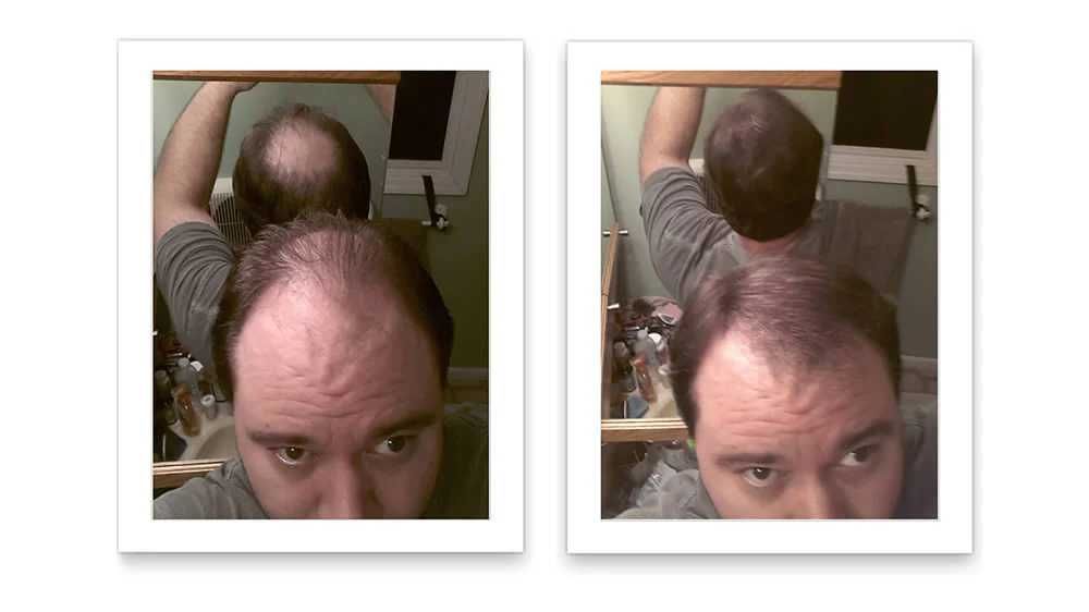 Fibre de par pentru par rar sau chelie - Hairify