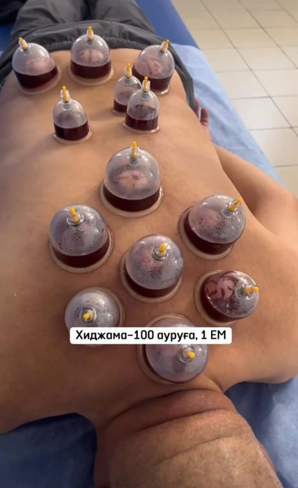 Хиджама Шымкент!!!