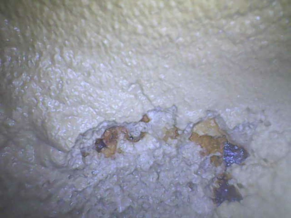 Эндоскоп, фото-видео, қызметі