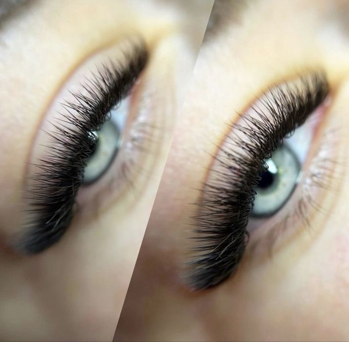 Gene de vis naturale