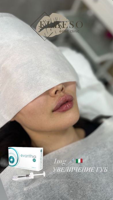 Плазмалифтинг, увеличение губ