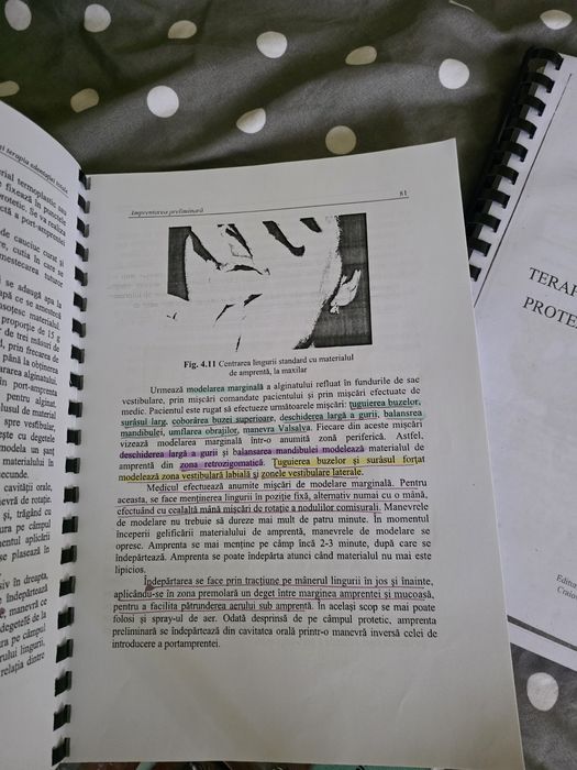 Terapia edentiei partiale, totale - medicina dentara