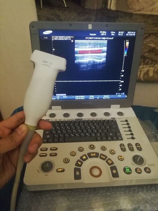 Uzi portativ apart. Samsung medison mysono u 6