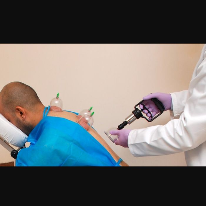 Xijoma va zukuk va hijoma хиджама