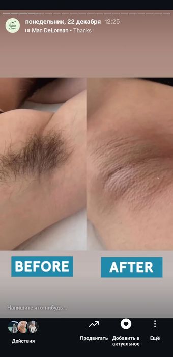 Шугаринг, skin's в мкр. Шугыла