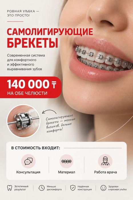 Брекеты самолигирующие