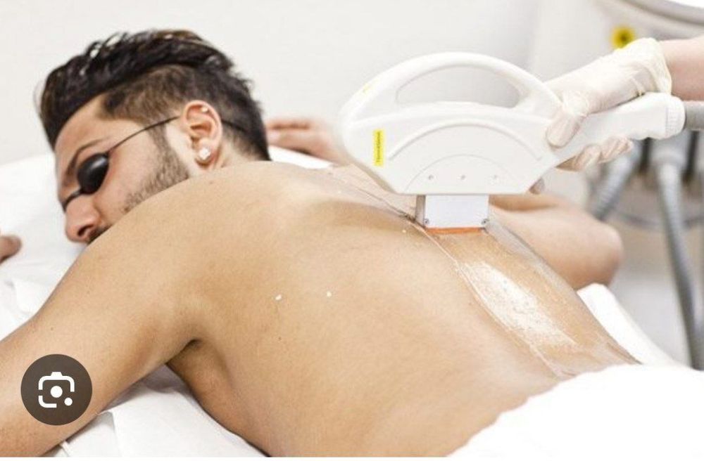 Мужской лазерная эпиляция скидки 400тыяч