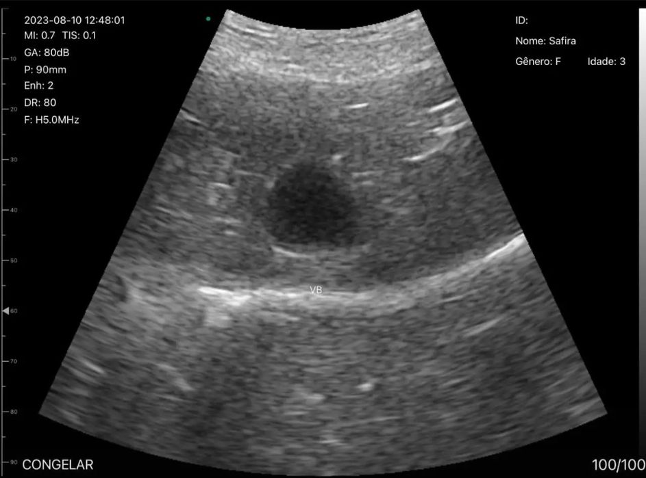 Узи датчик на телефон