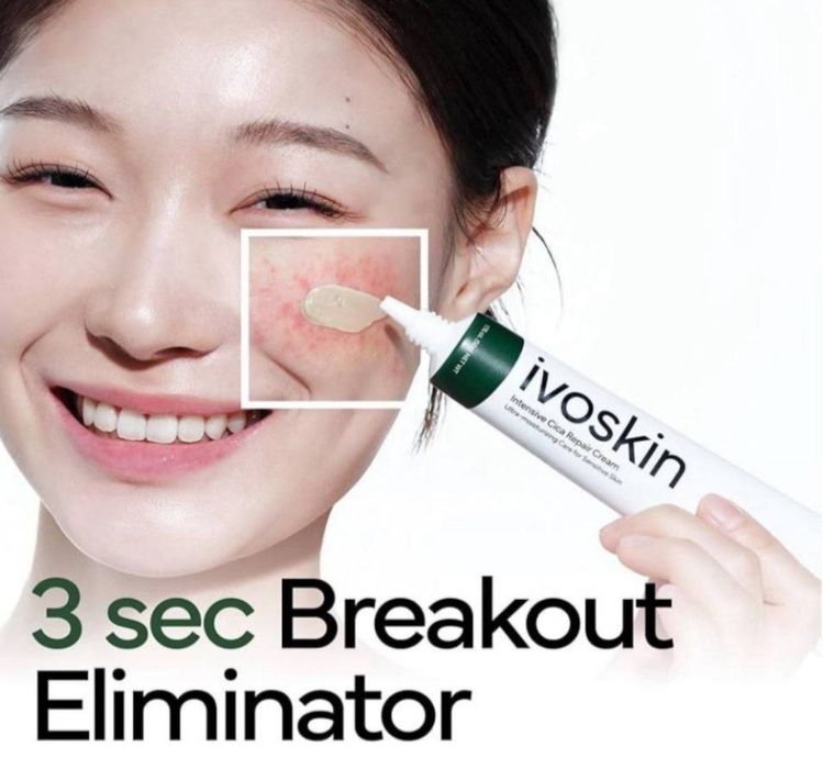 Yuz kremi,akne,toshmalar,doglar,крем,husnbuzar,7 kunda sezirarli natij