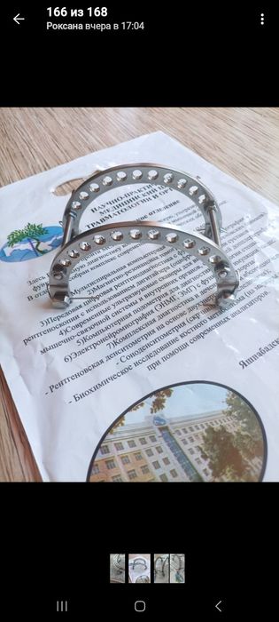 Аппарат Илизарова